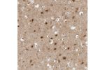 Immunohistochemical staining of human cerebral cortex shows strong nuclear positivity in neuronal cells.