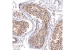 Immunohistochemical staining of human testis shows very weak cytoplasmic positivity in cells in seminiferous ducts.