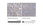 Immunohistochemistry analysis in human small intestine and pancreas tissues using HPA026109 antibody. Corresponding AKAP9 RNA-seq data are presented for the same tissues.