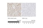 Immunohistochemistry analysis in human heart muscle and liver tissues using HPA026111 antibody. Corresponding NES RNA-seq data are presented for the same tissues.