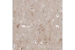 Immunohistochemical staining of human cerebral cortex shows moderate positivity in neuronal and glial cells and in neuropil.