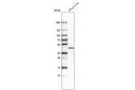 Western blot analysis in human cell line SCLC-21H.