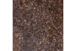 Immunohistochemical staining of human lymph node shows strong cytoplasmic positivity in germinal and non-germinal center cells.