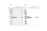 Western blot analysis using Anti-RPA2 antibody HPA026309 (A) shows similar pattern to independent antibody HPA026306 (B).