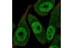 Immunofluorescent staining of human cell line PC-3 shows localization to nucleoplasm & cytosol.