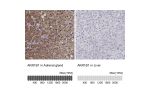 Immunohistochemistry analysis in human adrenal gland and liver tissues using HPA026425 antibody. Corresponding AKR1B1 RNA-seq data are presented for the same tissues.