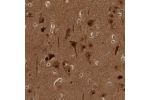 Immunohistochemical staining of human cerebral cortex shows strong nuclear and cytoplasmic positivity in neuronal cells.