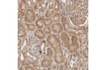 Immunohistochemical staining of human kidney shows moderate cytoplasmic positivity in cells in tubules and cells in glomeruli.