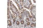 Immunohistochemical staining of human colon shows strong granular cytoplasmic positivity in glandular cells.