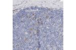 Immunohistochemical staining of human tonsil shows strong cytoplasmic positivity in germinal center cells.