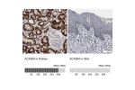 Immunohistochemistry analysis in human kidney and skin tissues using HPA026542 antibody. Corresponding ACADM RNA-seq data are presented for the same tissues.