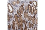 Immunohistochemical staining of human stomach shows strong membranous and cytoplasmic positivity in glandular cells.