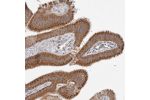 Immunohistochemical staining of human gall bladder shows strong cytoplasmic positivity in glandular cells.