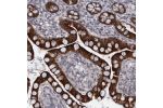 Immunohistochemical staining of human small intestine shows strong cytoplasmic positivity in glandular cells.