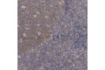 Immunohistochemical staining of human tonsil shows moderate cytoplasmic positivity in germinal center cells.