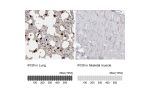 Immunohistochemistry analysis in human lung and skeletal muscle tissues using HPA026650 antibody. Corresponding IFI30 RNA-seq data are presented for the same tissues.