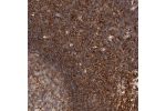 Immunohistochemical staining of human lymph node shows strong cytoplasmic positivity in non-germinal center cells.