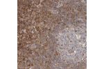 Immunohistochemical staining of human stomach shows strong cytoplasmic positivity in glandular cells.