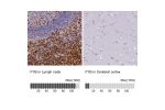 Immunohistochemistry analysis in human lymph node and cerebral cortex tissues using Anti-FYB antibody. Corresponding FYB RNA-seq data are presented for the same tissues.