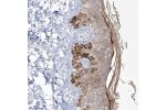 Immunohistochemical staining of human skin shows strong cytoplasmic positivity in the basal layer of epidermal cells.