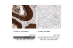 Immunohistochemistry analysis in human epididymis and kidney tissues using HPA026813 antibody. Corresponding SPINK2 RNA-seq data are presented for the same tissues.
