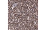 Immunohistochemical staining of human liver shows strong membranous positivity in hepatocytes.