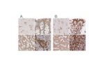Immunohistochemical staining of human cerebral cortex, colon, liver and tonsil using Anti-RPN1 antibody HPA026828 (A) shows similar protein distribution across tissues to independent antibody HPA051520 (B).