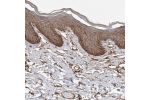 Immunohistochemical staining of human skin shows strong membranous positivity in squamous epithelial cells.