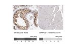 Immunohistochemistry analysis in human testis and skeletal muscle tissues using HPA026853 antibody. Corresponding SMARCC1 RNA-seq data are presented for the same tissues.