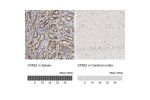 Immunohistochemistry analysis in human spleen and cerebral cortex tissues using HPA026871 antibody. Corresponding STAB2 RNA-seq data are presented for the same tissues.