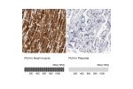 Immunohistochemistry analysis in human heart muscle and placenta tissues using HPA026900 antibody. Corresponding PLN RNA-seq data are presented for the same tissues.