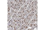 Immunohistochemical staining of human heart muscle shows strong positivity in intercalated discs.