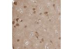 Immunohistochemical staining of human cerebral cortex shows moderate cytoplasmic positivity in neurons.