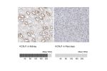 Immunohistochemistry analysis in human kidney and lymph node tissues using Anti-KCNJ1 antibody. Corresponding KCNJ1 RNA-seq data are presented for the same tissues.
