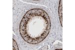 Immunohistochemical staining of human epididymis shows strong granular cytoplasmic positivity in glandular cells.