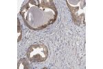 Immunohistochemical staining of human prostate shows moderate membranous positivity in glandular cells.