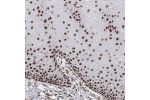 Immunohistochemical staining of human cervix, uterine shows strong nuclear positivity in squamous epithelial cells.