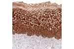 Immunohistochemical staining of human tonsil shows strong cytoplasmic positivity in reaction center cells.
