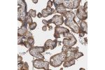 Immunohistochemical staining of human placenta shows moderate cytoplasmic positivity in trophoblastic cells.