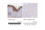 Immunohistochemistry analysis in human skin and skeletal muscle tissues using HPA027062 antibody. Corresponding CASP14 RNA-seq data are presented for the same tissues.