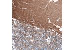 Immunohistochemical staining of human cerebellum shows moderate positivity in neuropil.