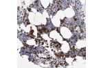Immunohistochemical staining of human bone marrow shows strong cytoplasmic / membranous positivity in hematopoietic cells.