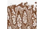 Immunohistochemical staining of human rectum shows strong membranous and cytoplasmic positivity in glandular cells.