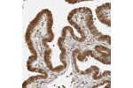 Immunohistochemical staining of human Fallopian tube shows strong cytoplasmic and nuclear positivity in glandular cells.