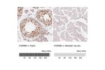 Immunohistochemistry analysis in human testis and skeletal muscle tissues using HPA027179 antibody. Corresponding KDM5B RNA-seq data are presented for the same tissues.