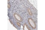 Immunohistochemical staining of human endometrium shows moderate cytoplasmic positivity in glandular cells.