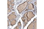 Immunohistochemical staining of human thyroid gland shows strong nuclear positivity in glandular cells.