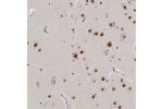 Immunohistochemical staining of human cerebral cortex shows strong nuclear positivity in neuronal cells.