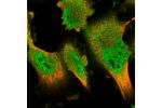 Immunofluorescent staining of human cell line U-251 MG shows localization to nucleoplasm & cytosol.