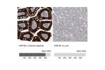 Immunohistochemistry analysis in human small intestine and liver tissues using Anti-KRT20 antibody. Corresponding KRT20 RNA-seq data are presented for the same tissues.